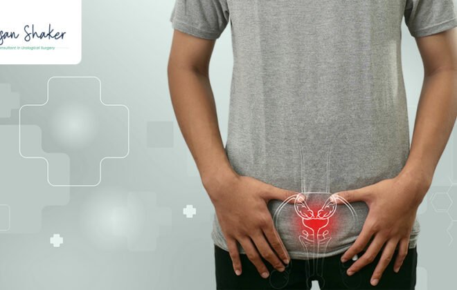 اورام البروستات الخبيثة